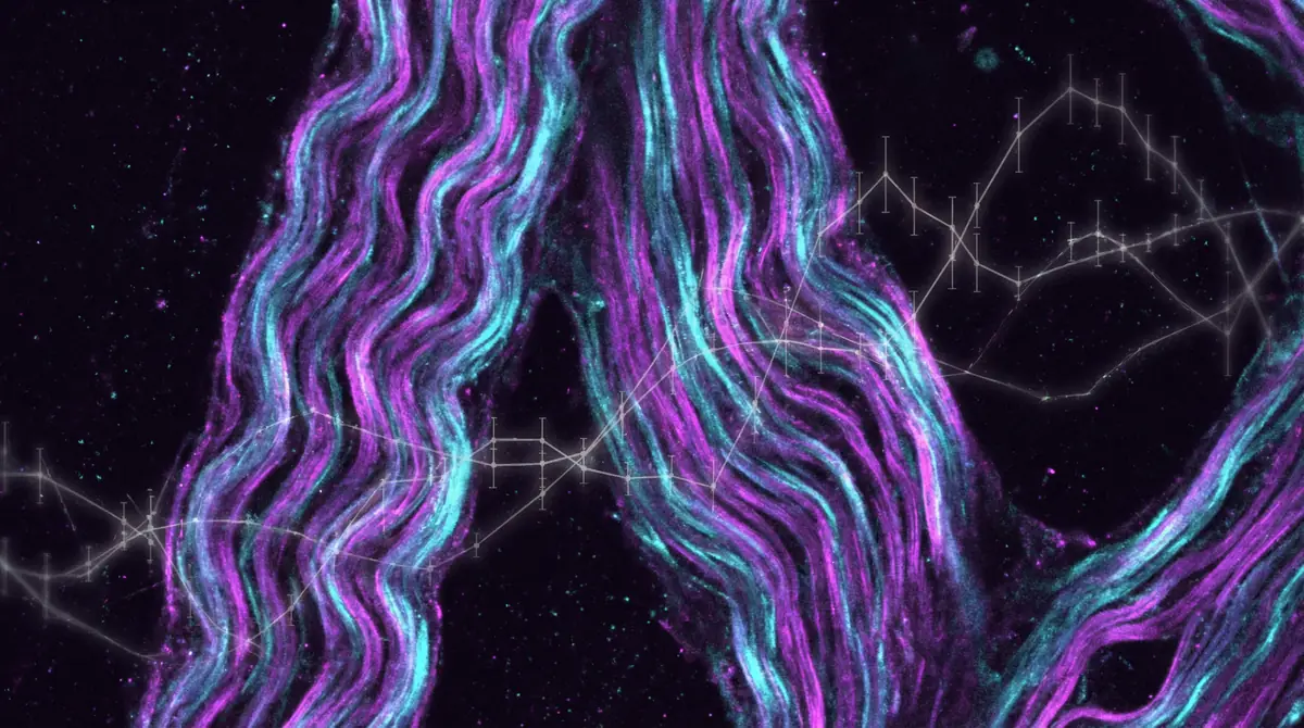 Fluorescent microscopy of tendon collagen fibers